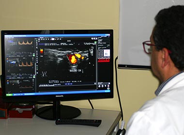 Ecocolordoppler