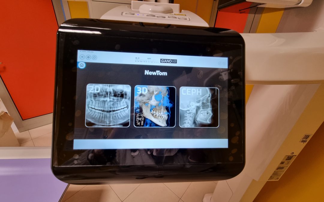 Dentalscan